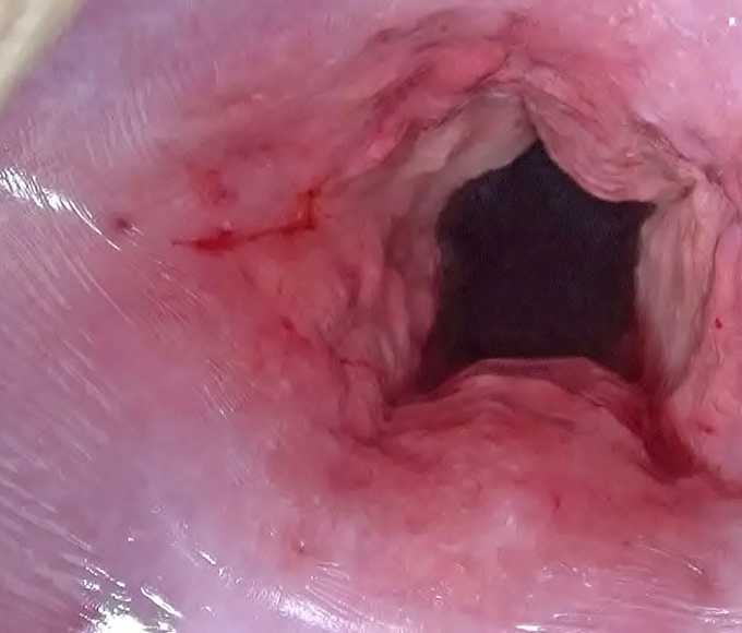 Japanese Cervix Stretching and Uterus Dilation with Penetration - Unleash Your Desires
